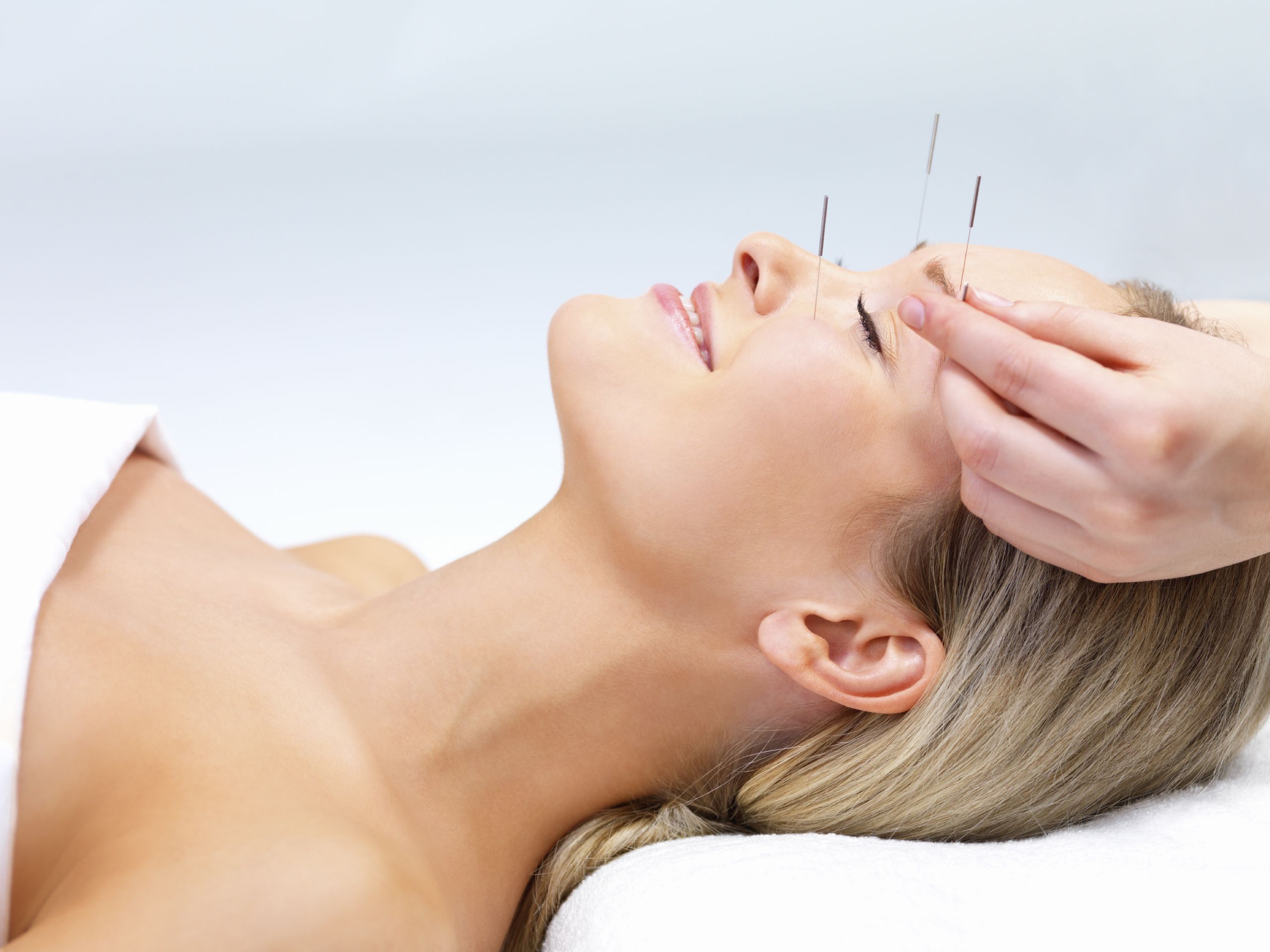 Tension Headaches and Migraines Respond To Acupuncture
