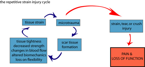 7 ways to relieve chronic scar tissue pain - Excel Sports PTExcel