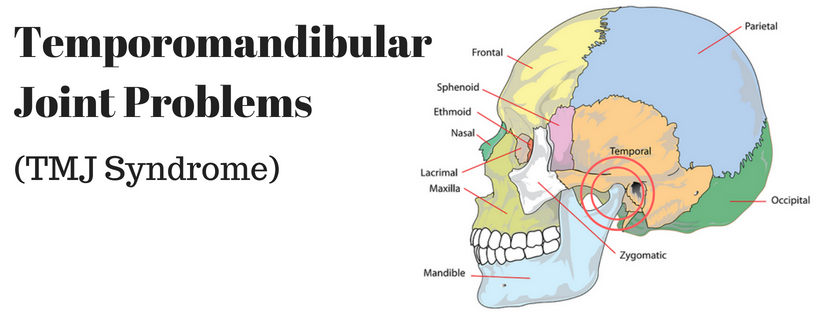 TMJ Problems, TMJ syndrome