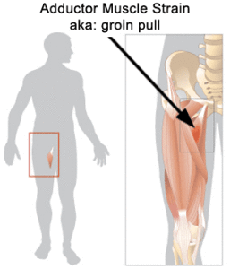 groin-strain-physiotherapy