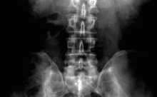 xrayspine