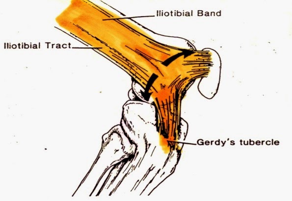 iliotibial band syndrome, IT band, knee pain, hip pain