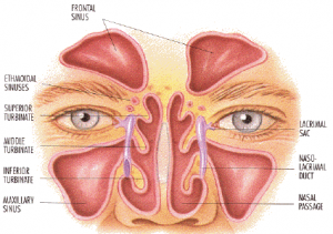 Asthma, Allergies and Sinuses