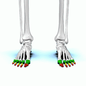 toe pain, metatarsal pain, metatarsals, foot pain, toe pain