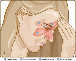 sinuses, cranial adjusting, cranial adjusting turner style, adjustments, treatment for sinuses,