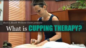 cupping, naturopathic, naturopathic care, cupping therapy